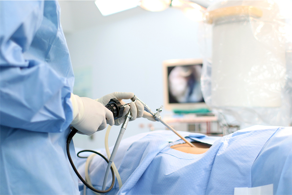 General-Minimal-Access-Surgery